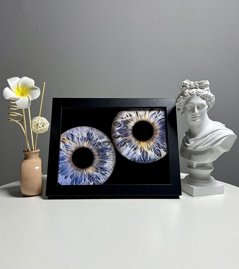 Музей радужки глаза